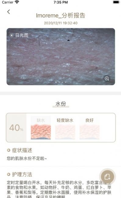 MoreMe水肤镜
