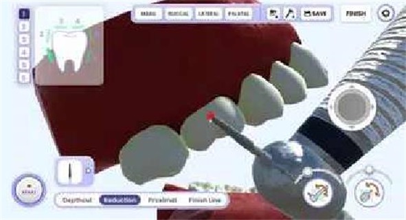 牙医模拟