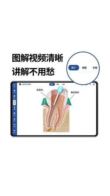一分钟报价