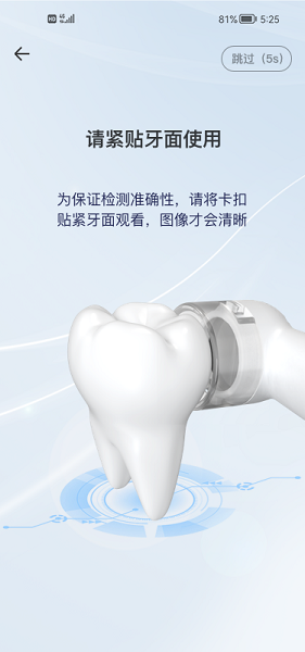 牙棒棒口腔